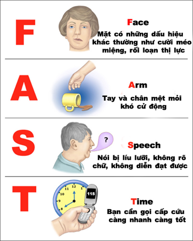 4. Cách Nhận Biết Đột Quỵ Qua Quy Tắc FAST